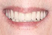 cosmetic after