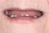 cosmetic before