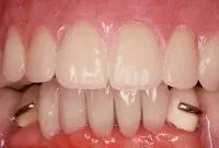cosmetic after