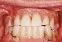 cosmetic before