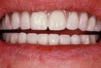 cosmetic after
