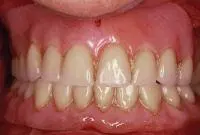 cosmetic before