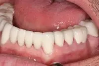 cosmetic after